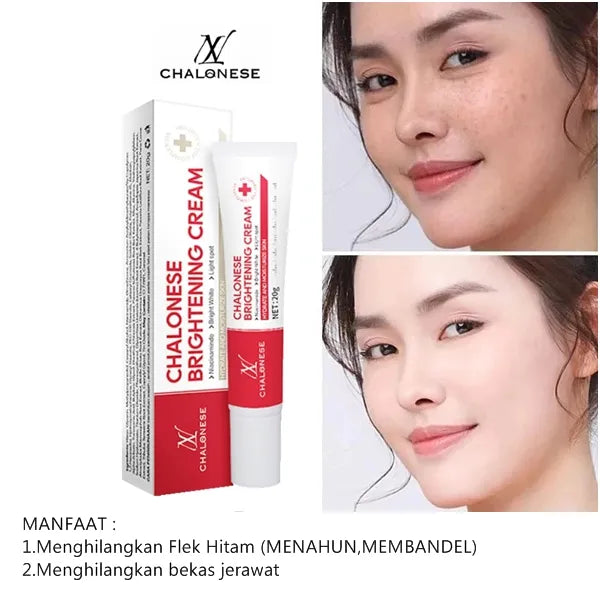 Chalonese Brightening Cream – Buy 1 Get 1 Free | Anti Pigmentation & Acne Marks Cream | 1499 PKR