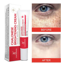 Chalonese Brightening Cream – Buy 1 Get 1 Free | Anti Pigmentation & Acne Marks Cream | 1499 PKR