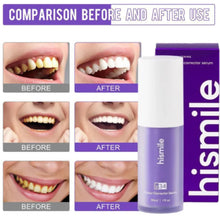 HiSmile V34 Teeth Whitening Serum