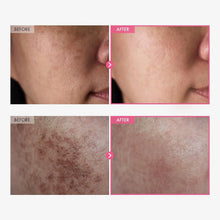 Buy 1 Get 1 FREE Arbutin 7% + TXA 4% Brightening Cream – 50ml